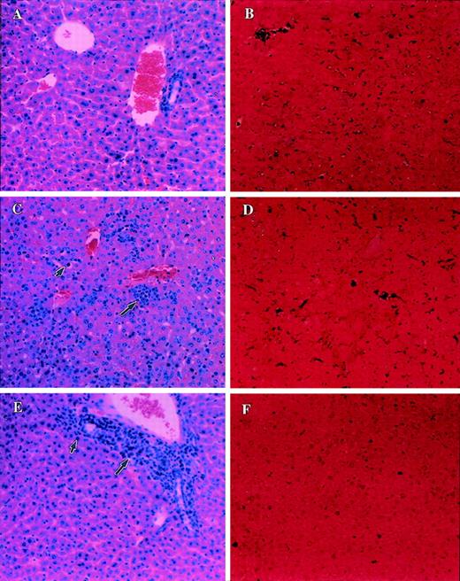 Fig. 6. Analysis of morphology and apoptosis in the liver of tumor-bearing C57BL/6 lpr/lpr mice. / Sections of liver from PBS-injected control C57BL/6 lpr/lprmice (A, B) or LSA tumor-bearing (C, D) or EL-4 tumor-bearing (E, F) were examined after H&E staining (A, C, E) or TUNEL assay (B, D, F) to detect apoptosis. Small and large arrows represent infiltration of tumor cells and lymphocytes, respectively. Dark purple staining in D and F indicates the apoptosis.