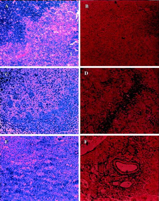 Fig. 7. Analysis of morphology and apoptosis in the thymus of tumor-bearing C57BL/6 +/+ mice. / Section of thymus from PBS-injected control (A, B) or LSA tumor-bearing (C, D) or EL-4-tumor bearing (E, F) mice were examined after H&E staining (A, C, E) or TUNEL assay to detect apoptosis (B, D, F). More tumor cell infiltration was observed in the thymus than in the liver.