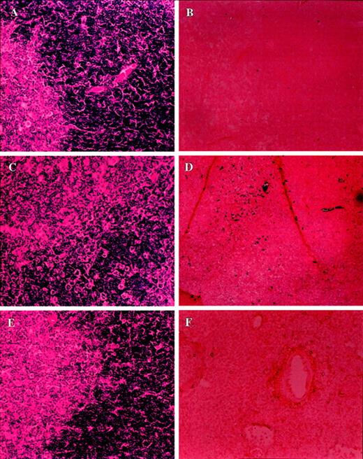 Fig. 8. Analysis of morphology and apoptosis in the thymus of tumor-bearing C57BL/6 lpr/lpr mice. / Sections of thymus from PBS-injected control (A, B) or LSA tumor-bearing (C, D) or EL-4-tumor bearing (E, F) mice were examined after H&E staining (A, C, E) or TUNEL assay to detect apoptosis (B, D, F). More tumor cell infiltration was observed in the thymus than the liver.