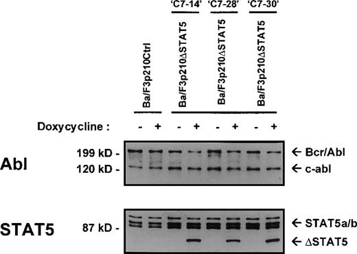Fig. 1. Expression of ▵STAT5 and p210Bcr/Abl in Ba/F3-p210 cells. / Ba/F3 cells transfected with p210Bcr/Abl and either the empty pTRE plasmid (Ba/F3p210Ctrl) or pTRE ΔSTAT5 (Ba/F3p210ΔSTAT5) were maintained in either the presence or absence of doxycycline (1 μg/mL) for 18 hours and then subjected to Western blot analysis. Although all cell lines were found to express both forms of STAT5 (STAT5A and STAT5B), incubation with doxycycline induced the truncated form of STAT5 (estimated molecular weight, 78 kd) in 3 clones of Ba/F3p210ΔSTAT5 (lower panel). No induction of ΔSTAT5 protein was found in Ba/F3p210Ctrl cells. Probing with an Abl antibody revealed expression of c-abl (145 kd) and of p210Bcr/Abl (210 kd) (upper panel).