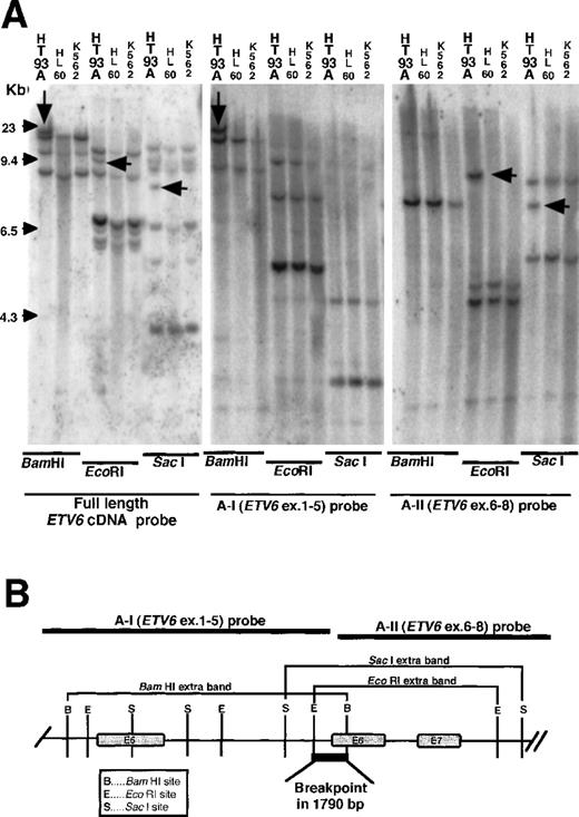 Fig. 3. Genomic Southern hybridization with the ETV6probes. / (A) With the full length ETV6 cDNA probe, additional bands were found only in the HT93A cells, but not in control cells. The additional bands on Bam HI, EcoRI, and SacI digests were hybridized with A-I probe and A-II probe, respectively. (B) Schematic representation of genomic breakpoint in the HT93A cells. Taking into account the restriction map of ETV6, the breakpoint is deduced to localize in a 1780 bp region that encompasses intron 5 and exon 6 ofETV6.