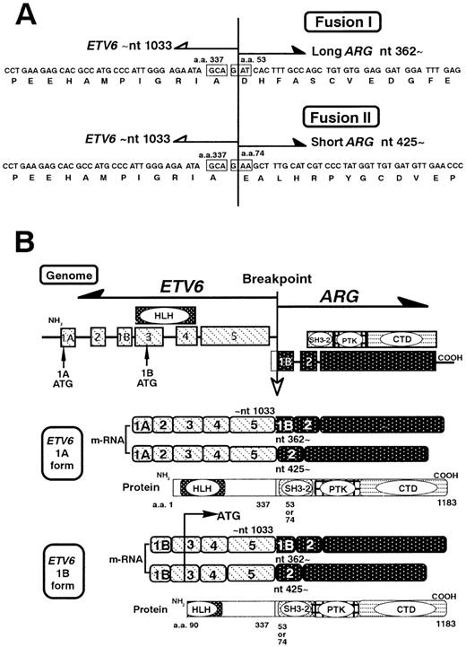 Fig. 5. Schematic representation of the ETV6/ARG fusion transcripts. / (A) The nucleotides and deduced amino acid sequence of the ETV6/ARGfusion transcripts. Two fusion breakpoints of the ARG were detected, at nt 362 and nt 425. Both fusions contain the ETV6up to nt 1033, and are in-framed. (B) ETV6 has alternative exon 1A and 1B. Four kinds of the ETV6/ARG transcripts were found. The 1A form ETV6 encodes a complete PNT domain, whereas the 1B form ETV6 encodes a truncated PNT domain, because the translation starts at ATG in exon 3.