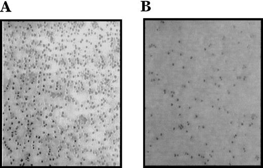Fig. 1. Enhanced proliferation and cluster formation of ▵716 cells grown in G-CSF. / Ba/F3 cells transfected with the wild-type (WT) (A, B) or Δ716 G-CSFR (C, D) were grown for 4 days in RPMI 1640 + 10% FBS containing either 10% WEHI-CM as a source of IL-3 (A, C) or 1.9 ng/mL G-CSF (B, D). Cells were examined by inverted microscopy at 200 × and photographed.