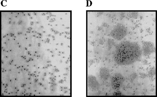 Fig. 1. Enhanced proliferation and cluster formation of ▵716 cells grown in G-CSF. / Ba/F3 cells transfected with the wild-type (WT) (A, B) or Δ716 G-CSFR (C, D) were grown for 4 days in RPMI 1640 + 10% FBS containing either 10% WEHI-CM as a source of IL-3 (A, C) or 1.9 ng/mL G-CSF (B, D). Cells were examined by inverted microscopy at 200 × and photographed.