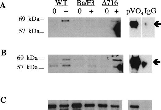 Fig. 5. Induction of S and T phosphorylation of Akt by G-CSF. / Parental Ba/F3 cells or Ba/F3 cells transfected with the WT G-CSFR or the Δ716 G-CSFR were untreated (0) or stimulated with 100 ng/mL G-CSF (+) for 10 minutes, then lysed and immunoprecipitated with anti-Akt antibody. (A) Immunoblotting with anti–phospho-Akt (S473). (B) The blot in (A) was stripped and reblotted with antibody recognizing Akt phosphorylated at T308. (C) The blot in (B) was stripped and reblotted with anti-Akt to assess for equivalent protein loading. Arrows indicate the phosphorylated forms of Akt. Peroxyvanadate (pVO4)-stimulated Δ716 cells are shown as a positive control. Δ716 cells immunoprecipitated with normal sheep serum (IgG) instead of anti-Akt antibody represent a negative control.