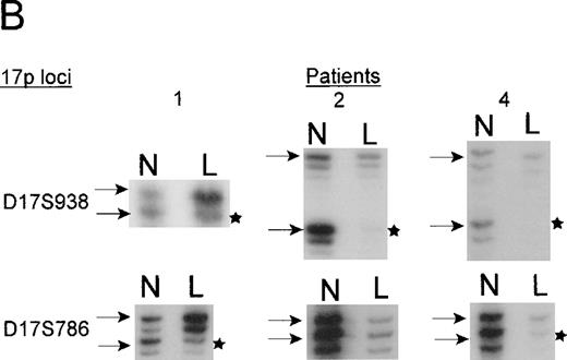 Fig. 4. A. The ordering of markers within the region is based on published mapping data from the SHGC. / Distances in centirays (cR) are from the p-arm telomere as determined by the SHGC. B. Loss of heterozygosity analysis of polymorphic markers at 17p13. Paired samples of DNA from peripheral blood granulocytes or bone marrow blasts and mononuclear cells were PCR amplified for each of the 17p13 polymorphic markers. The presence of 2 alleles in the mononuclear cells rendered a given patient informative for the specific locus. LOH = loss of heterozygosity. N = normal sample. L = leukemic sample. Arrows mark the location of alleles. Stars indicate allele loss.