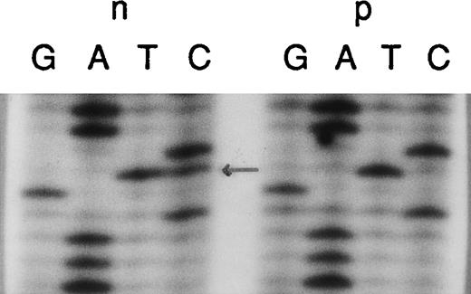 Fig. 6. Identification of the “pseudogene marker” TG in intron 1. / Genomic DNA from a normal individual (n) and an A47° CGD patient (p) was amplified using the primers 1LA, 1LB, 2RC, and 2RD. The PCR products contained the 3′ end of intron 1 and the entire exon 2. In the patient sample, only the “pseudogene marker” TG located in intron 1 122-bp upstream from the 5′ end of exon 2 is present. The normal individual typically showed both sequences, the wild type CG and the pseudogene TG (arrow). Sequence analysis of the antisense DNA strand or restriction analysis with Aci1 (c/cgc) confirmed these data (not shown).