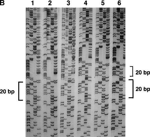Fig. 7. Sequence analysis of the 5′ region of intron 2. / (A) Genomic DNA from healthy individuals (n1 and n2) and A47° CGD patients (p1 and p2) was amplified using the primers 2LA, 2LB, 2RA, and 2RB. The PCR product of the pseudogene contained the 20-bp duplication located 176-bp downstream of the 5′ end of intron 2. Patient p1 had only the 20-bp duplication characteristic for the pseudogenes, whereas patient p2 and healthy individuals showed both the single 20-bp sequence of the wild-type gene and the 20-bp duplication, as indicated by 2 overlying sequences in intron 2. (B) Direct sequence analysis of fragments amplified across the 5′ region of intron 2 using the above primers and directly subcloned into pTA (Invitrogen). Sequence analysis used the reverse primer, and the orientation of the nucleotides is T, G, C, and A across the 4 lanes for each reaction. The DNA template for PCR was normal genomic DNA, and individual clones were analyzed in lanes 1, 2, 4, 5, and 6. Lane 3 represents a 1:1 mixing of the clones sequenced in lanes 1 and 4. Lanes 1 and 2 demonstrate the wild-type sequence, which includes only 1 copy of the 20-bp repeat unit CAGGGTCTTGCTCTGTCACC, whereas lanes 4, 5, and 6 show the repeat (indicated by brackets).