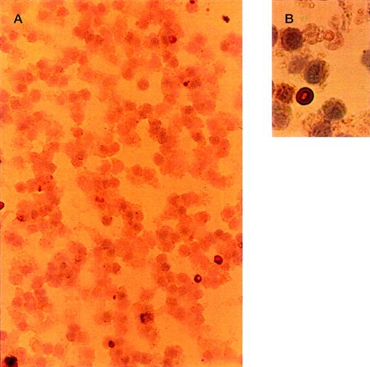 Fig. 2. Light microscopy of nonparenchymal liver cells for the presence of oxidatively damaged red blood cells at 30 minutes after injection. / Cells were isolated as described in “Materials and methods.” Cytospins were fixed in acetone, stained with 3,3′-diaminobenzidine for endogenous peroxidase activity, and counterstained with hematoxylin. Red blood cells are dark brown. (A, B) Cells eluted at a flow rate of 26 mL/min (liver endothelial cells). (C, D) Cells eluted at a flow rate of 75 mL/min (Kupffer cells). Objective magnification ×40 (A, C); ×100 (B, D). The procedure was repeated 3 times and gave very similar results.