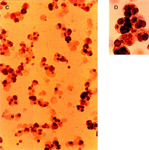 Fig. 2. Light microscopy of nonparenchymal liver cells for the presence of oxidatively damaged red blood cells at 30 minutes after injection. / Cells were isolated as described in “Materials and methods.” Cytospins were fixed in acetone, stained with 3,3′-diaminobenzidine for endogenous peroxidase activity, and counterstained with hematoxylin. Red blood cells are dark brown. (A, B) Cells eluted at a flow rate of 26 mL/min (liver endothelial cells). (C, D) Cells eluted at a flow rate of 75 mL/min (Kupffer cells). Objective magnification ×40 (A, C); ×100 (B, D). The procedure was repeated 3 times and gave very similar results.