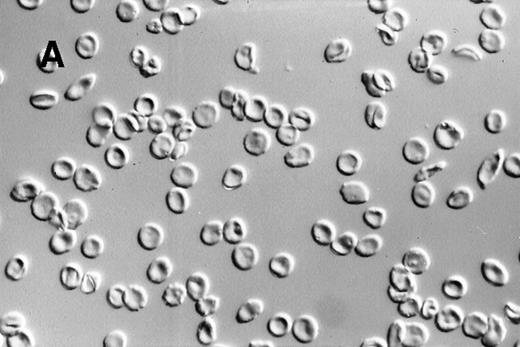 Fig. 2. Photomicrographs of fixed sickle red blood cells from a typical experiment. / (A) Results after 4 hours of incubation at 37°C under oxygenation conditions. (B) Photomicrograph obtained from the oxygenation port after 3.67 hours of cycling. (C) Photomicrograph obtained from the deoxygenation port after 3.67 hours of cycling. (D) Results after 4 hours of cycling followed by oxygenation.