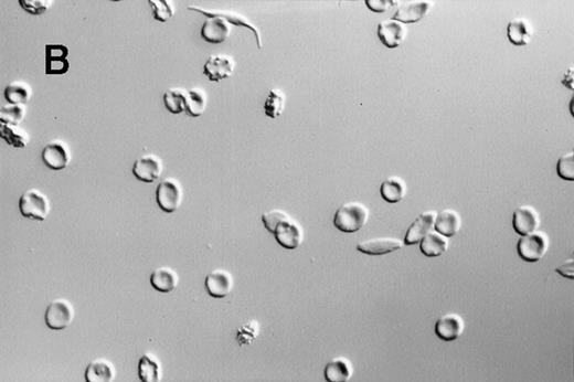 Fig. 2. Photomicrographs of fixed sickle red blood cells from a typical experiment. / (A) Results after 4 hours of incubation at 37°C under oxygenation conditions. (B) Photomicrograph obtained from the oxygenation port after 3.67 hours of cycling. (C) Photomicrograph obtained from the deoxygenation port after 3.67 hours of cycling. (D) Results after 4 hours of cycling followed by oxygenation.