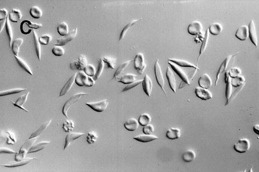 Fig. 2. Photomicrographs of fixed sickle red blood cells from a typical experiment. / (A) Results after 4 hours of incubation at 37°C under oxygenation conditions. (B) Photomicrograph obtained from the oxygenation port after 3.67 hours of cycling. (C) Photomicrograph obtained from the deoxygenation port after 3.67 hours of cycling. (D) Results after 4 hours of cycling followed by oxygenation.
