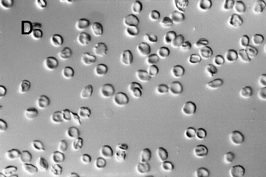 Fig. 2. Photomicrographs of fixed sickle red blood cells from a typical experiment. / (A) Results after 4 hours of incubation at 37°C under oxygenation conditions. (B) Photomicrograph obtained from the oxygenation port after 3.67 hours of cycling. (C) Photomicrograph obtained from the deoxygenation port after 3.67 hours of cycling. (D) Results after 4 hours of cycling followed by oxygenation.