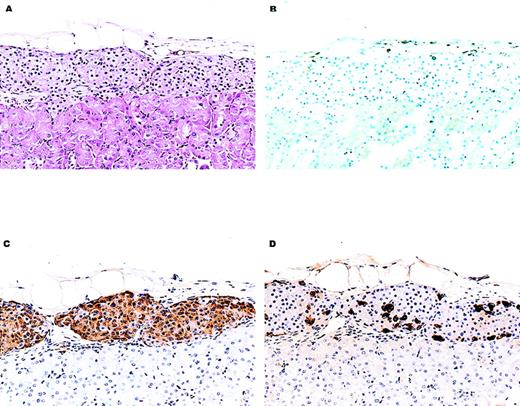 Fig. 3. Histology of a representative C57BL/6 islet allograft from a chimeric NOD/Lt recipient. / Shown are histologic sections of C57BL/6 islet tissue that had been transplanted into the renal subcapsular space of a chimeric NOD/Lt mouse. The NOD/Lt recipient had developed spontaneous autoimmune diabetes and had been treated with radiation and anti-CD154 mAb and C57BL/6 bone marrow about 4 weeks before islet transplantation (see “Materials and Methods”). This recipient was normoglycemic for 124 days after transplantation and became hyperglycemic immediately after recovery of the kidney bearing the islet tissue shown here. (A) Hematoxylin and eosin–stained section showing normal appearing islet tissue. An inflammatory infiltrate (× 150) was not evident. (B) A frozen section stained immunohistochemically for the presence of the CD3+ lymphocytes. There is no appreciable CD3+ T-cell infiltrate (× 150). (C, D) Sections stained immunohistochemically for the presence of insulin and glucagon, respectively. Abundant hormone-containing cells are visible (× 150).
