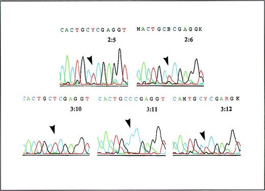 Fig. 2. Analysis of cDNA from patient 3:10, his parents, and his siblings. / A PCR product containing the region around 473C of the GLCLC gene was generated from cDNA and was analyzed by Dye Primer Cycle sequencing. The results show (arrows) that the parents 2:5 and 2:6 are both heterozygous for the 473C→T substitution in the GLCLC gene, patient 3:10 is homozygous for this mutation, his sister 3:11 is normal, and his brother 3:12 is heterozygous.