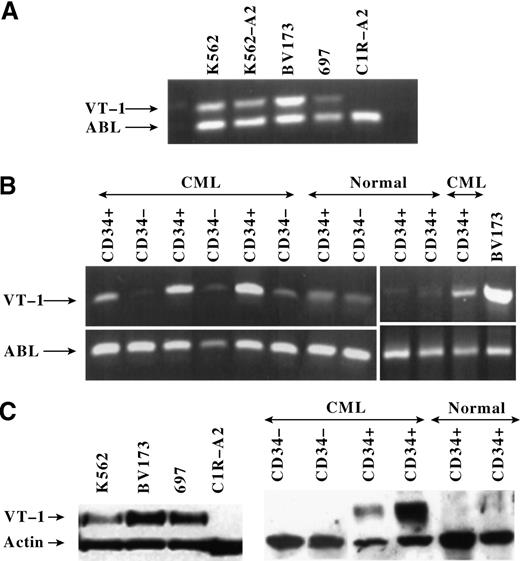 Fig. 2. WT1 RNA and protein expression in leukemic cell lines and in CD34+ and CD34− cell populations freshly isolated from patients with leukemia and normal donors. / (A) RT-PCR to measure WT1 RNA in leukemic cell lines and in the B-lymphoid cell line C1R-A2. The same cell lines were used as CTL targets in Figure 1C. The amplified WT1 product is 482 bp long. The RNA of the housekeeping ABL gene was amplified to indicate the amount of RNA in each sample. The ABL product is 385 bp long. (B) RT-PCR to measure WT1 RNA expression in purified CD34+ and CD34− cell populations from 4 patients with CML and 3 normal donors. The leukemic cell line BV173 served as a positive control for WT1 expression. Similar results were obtained with samples from 6 additional patients with CML. (C) Western blotting to measure WT1 protein expression in leukemia cell lines and in purified CD34+ and CD34− cell populations from 2 patients with CML and 2 normal donors. The expression of the housekeeping actin protein was used as an indicator to control for the amount of protein in each sample. The WT1 protein measures approximately 54 kd and the actin protein approximately 42 kd.
