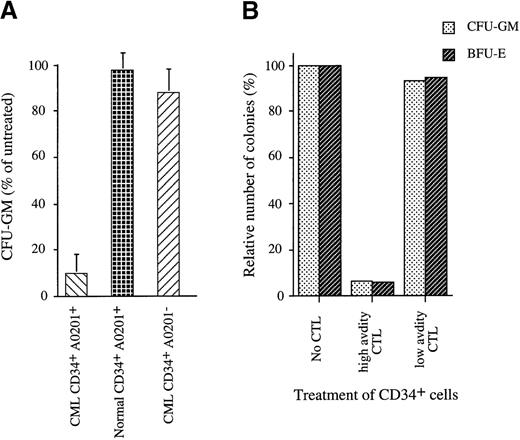 Fig. 4. Analysis of CTL-mediated inhibition of colony formation of CD34+ cell populations purified from patients with leukemia and normal donors. / (A) CTL-mediated inhibition of colony formation by purified CD34+ cells cocultured for 4 hours with CTL at an effector/target cell ratio of 10:1. Untreated control CD34+cells were cultured under the same conditions without CTL. CTL treated and untreated control cells were then plated in methylcellulose, and after 14 days the numbers of granulocyte macrophage colony-forming units (GM-CFU) were counted. Shown is the percentage of GM-CFU after CTL treatment using the GM-CFU observed in the untreated controls as 100% reference. This figure shows the mean and standard deviation of independent experiments with CD34+ cells from 9 HLA-A0201+ patients with CML and 7 normal donors and with CD34+ cells from 5 HLA-A0201− patients with CML. (B) Colony formation by A0201+/CD34+CML cells that were untreated or treated for 4 hours with high-avidity P126-specific CTL (line 81) or with low-avidity CTL (line 85) before plating. Shown are GM-CFU and BFU-E using the number of colonies observed in the untreated controls as 100% reference.