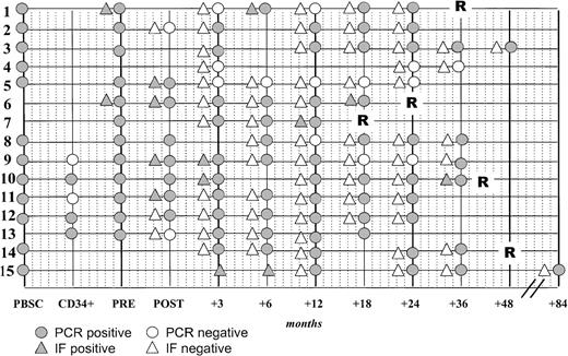 Fig. 2. Molecular follow-up of myeloma patients who achieved serologic and clinical CR after TX1 or TX2. / Nos. 1 to 8 and 9 to 13 represented double autotransplants supported with PBSC or CD34+ cells, respectively, whereas Nos. 14 and 15 were patients who were submitted to a single course of high-dose therapy with unmanipulated stem cells.