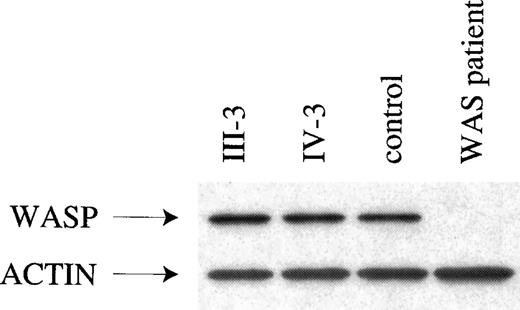 Fig. 2. Evaluation of WASP by Western blot analysis. / Western blot evaluations are given for the following: WASP and actin from 2 affected males with XLTT, an unrelated normal control, and an individual with classic WAS. The patient with classic WAS carries a nonsense mutation in theWAS gene, which results in absence of detectable WASP.