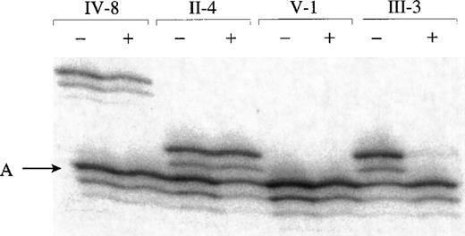 Fig. 3. Evaluation of X-inactivation patterns in 4 obligate carriers of XLTT. / DNA digested with RsaI (lanes marked −) or RsaIand HpaII (lanes marked +) was PCR amplified using primers for HUMARA. Only alleles on inactive X chromosomes are amplified followingHpaII digestion. The allele carried by affected males is denoted A (data not shown). HUMARA lies just distal to the minimal region containing XLTT, and there were no recombinations between XLTT and HUMARA in individuals III-3, III-5, or IV-3. Although carriers IV-8 and V-1 were not included in the linkage analysis, they each must have inherited the X chromosome from their affected fathers, without any further recombinations.
