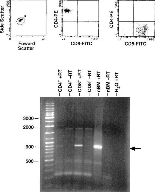 Fig. 5. Expression of G-CSF mRNA in PB CD4+ and CD8+ cells. / Purified CD4+ and CD8+ cells were derived by sorting PBMCs obtained from a normal healthy control. mRNA was extracted from the cells, and RT-PCR was performed using G-CSFR–specific primers. RT-PCR products were electrophoresed in agarose gel containing ethidium bromide and visualized under ultraviolet light. Unseparated normal bone marrow (nbm) from a normal control was used as a positive control.