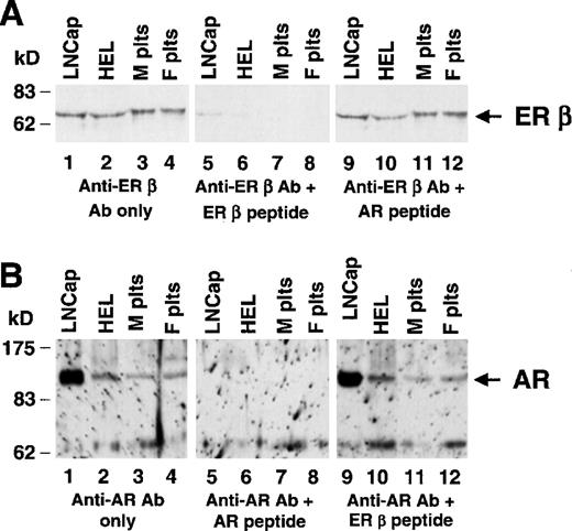 Fig. 4. Identification of the AR and ER β in normal human platelets. / Lysates from human cell lines or normal human platelets were analyzed by immunoblotting with polyclonal antisera specific for ER β (panel A) and for the AR (panel B). Total lysates were made from the prostate carcinoma cell line LNCap (lane 1), HEL (lane 2), normal male platelets (lane 3), and normal female platelets (lane 4). For both panels A and B, the same molarity of peptide was used in lanes 5-8 as in lanes 9-12, and the filter shown in lanes 5-8 was stripped and reprobed and shown to contain ER β and AR, respectively (not shown). (A) In all lanes, 40 μg of protein lysates were loaded. Filters were probed with a 1.5 μg/mL of anti-ER β (Upstate Biotechnology, Inc) without (lanes 1-4) or with (lanes 5-12) the indicated competing peptide. (B) Twenty micrograms of LNCap and HEL cell lysates and 40 μg of platelet lysates were electrophoresed. Filters were probed with 0.15 μg/mL PG-21 (Upstate Biotechnology, Inc) without (lanes 1-4) or with (lanes 5-12) the indicated competing peptide, as described in “Materials and methods.”