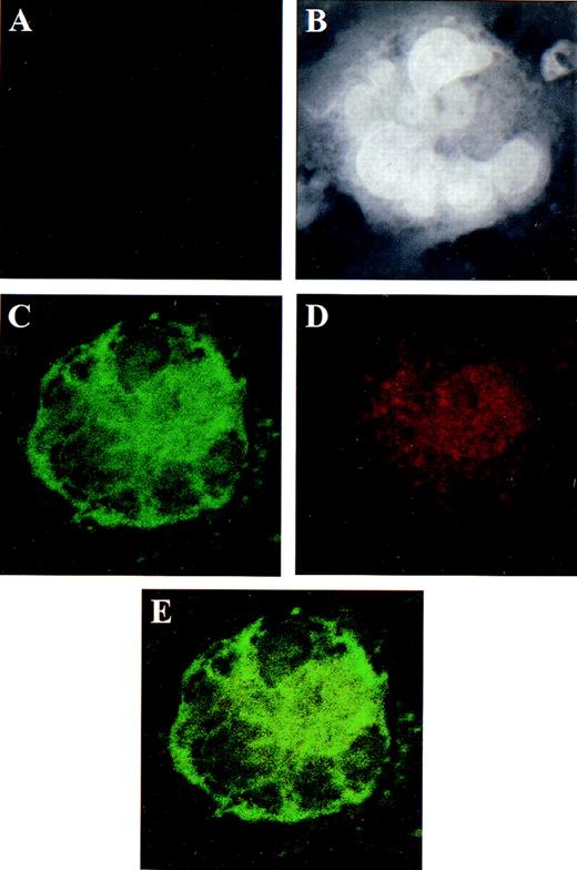Fig. 2. Localization of ER β in human megakaryocytes using dual color immunofluorescence microscopy. / CD34+ bone marrow cells, grown in serum-free and phenol-red–free medium, were treated for 7 days with PEG-rhMGDF and harvested for microscopy. (A) Negative control using mouse and rabbit IgGs as irrelevant primary antibodies. The same field is shown in panels B through E. (B) Dapi staining of nucleic acid. The polyploid nucleus is easily appreciated. (C) GPIIb detected by monoclonal antibody SZ22 (green). (D) ER β detected by specific rabbit polyclonal antisera (red). (E) The co-localization of GPIIb and ER β shown by summing the channels used in panels C and D. Although both GPIIb and ER β localize predominantly to the cytoplasm, the intensity of the GPIIb stain dominates in panel E to the extent that less yellow color is appreciated. Original magnification of panels B through E: ×1300.