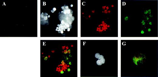 Fig. 3. Localization of AR in human megakaryocytes using dual color immunofluorescence microscopy. / Similar to Figure 2 except that antisera specific for AR were used. (A) Negative control using mouse and rabbit IgGs as irrelevant primary antibodies. The same field of cells is shown in panels B through E. (B) Dapi staining of nucleic acid. (C) AR detected by specific rabbit polyclonal antisera C-19 (red). (D) GPIIb (green). (E) The co-localization of GPIIb and AR shown by summing the channels used in panels C and D. Panels F and G contain the same cell to emphasize the polyploid features of the megakaryocyte. (F) Dapi staining of nucleic acid. (G) Co-localization of GPIIb and the AR. Original magnification for panels B through E: ×1000. Original magnification for panels F and G: ×600.