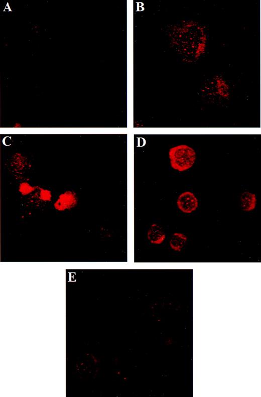 Fig. 5. Testosterone modulates AR expression in HEL cells. / HEL cells were grown for 48 hours in 10% FBS, with or without testosterone, and stained for AR as described above. Cells were incubated with 0 nmol/L (panel A), 1 nmol/L (panel B), 5 nmol/L (panel C), 10 nmol/L (panel D), and 100 nmol/L (panel E) testosterone. Testosterone requires ethanol to go into suspension, and all experiments had ethanol at a final concentration of 0.001%. The reduction in AR in cells treated with ethanol alone (panel A) is expected.37 Original range of magnifications: ×800 to ×2400.
