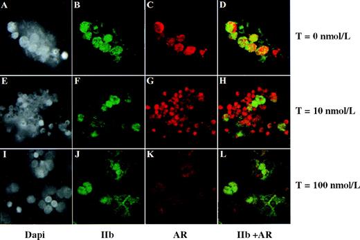 Fig. 6. Testosterone modulates AR expression in megakaryocytes. / CD34+ cells, grown in serum-free and phenol-red–free medium, were cultured in PEG-rhMGDF and 0 nmol/L, 10 nmol/L, or 100 nmol/L testosterone (T) as indicated for 13 days. Each experiment had a final concentration of 0.01% ethanol. Each row represents the same field of cells. Only approximately 10% of the total population of CD34-derived cells were negative for AR, suggesting that AR expression is widespread among CD34-derived cells. Staining with Dapi, GPIIb, and AR were as described in Materials aand methods. Original range of magnification for panels A through J: ×1200 to ×1400.