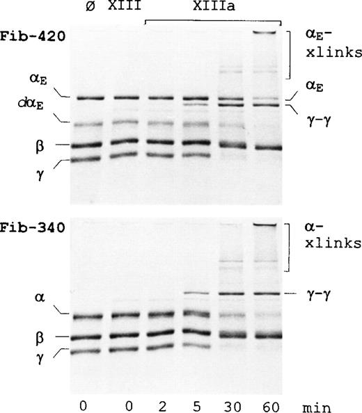 Fig. 4. Time course of factor XIIIa-catalyzed cross-linking. Cross-linking reactions with either fibrinogen-420 (upper panel) or fibrinogen-340 (lower panel) were carried out as described in “Materials and methods.” Lane 1 contains substrate alone. Lanes 2 to 6 contain substrate with either nonactivated factor XIII (lane 2) or thrombin-activated factor XIIIa (lanes 3-6), incubated for 2 minutes (lane 3), 5 minutes (lane 4), 30 minutes (lane 5), or 60 minutes (lane 6). Proteins were separated on homogenous 12% SDS-PAGE gels under reducing conditions and stained. Positions of individual and cross-linked fibrinogen chains are indicated. dαErefers to degraded αE, αE-xlinks refers to cross-linked αE chains, and α-xlinks refers to cross-linked α chains.