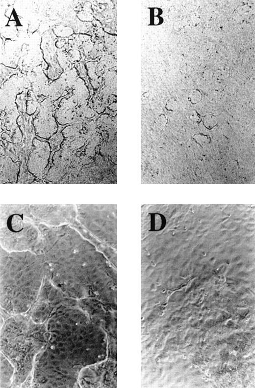 Fig. 4. Involvement of 12-LOX in endothelial cell tubelike differentiation. / The formation of cordlike structures by RV-ECT cells was facilitated by Matrigel as detailed in “Materials and methods.” (A) RV-ECT treated with ethanol as control. Original magnification, ×40. (B) RV-ECT treated with 10 μmol/L BHPP. Original magnification, ×40. (C) RV-ECT treated with ethanol as control. Original magnification, ×100. (D) RV-ECT treated with 10 μmol/L BHPP. Original magnification, ×100. Shown here are typical observations from 4 independent studies on the tube-forming ability of RV-ECT and the effect of BHPP.