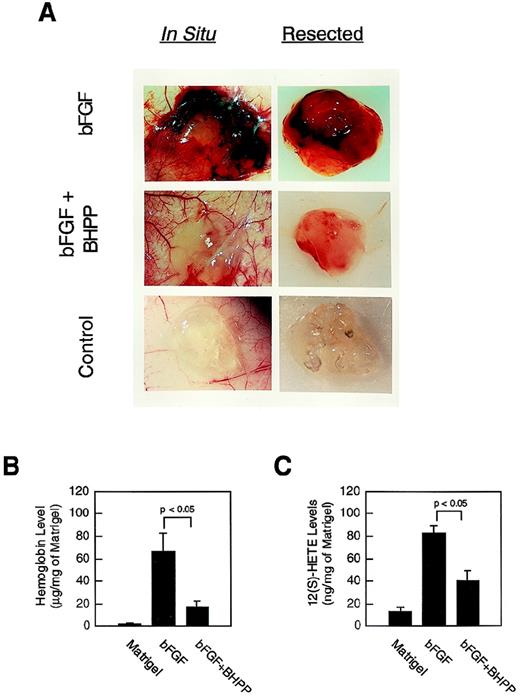 Fig. 6. Attenuation of angiogenesis in vivo by 12-LOX inhibitors. / Matrigel implantation assay for angiogenesis was performed as described in “Materials and methods” and repeated at least 3 times with similar results. (A) Matrigel implantation angiogenesis assay. Top panel: left, bFGF (5 μg/mL Matrigel) in situ; right, bFGF (5 μg/mL Matrigel) resected Matrigel. Middle panel: left, bFGF (5 μg/mL Matrigel) and BHPP (0.8 mg/mL Matrigel) in situ; right, bFGF (5 μg/mL Matrigel) and BHPP (0.8 mg/mL Matrigel) resected implant. Bottom panel: left, Matrigel alone in situ; right, resected Matrigel blank control. (B) Hemoglobin levels in resected implants. The hemoglobin was measured by Drabkin's reagent. Columns, hemoglobin levels normalized with protein concentrations. Bars, SE from quadruplicate samples. (C) 12(S)-HETE levels in resected implants. Lipids were extracted from the resected implants, and 12(S)-HETE levels were measured as described in “Materials and methods.” Columns, average 12(S)-HETE levels normalized with protein concentrations. Bars, SE (n = 4 for Matrigel control; n = 3 for bFGF; n = 5 for bFGF plus BHPP).