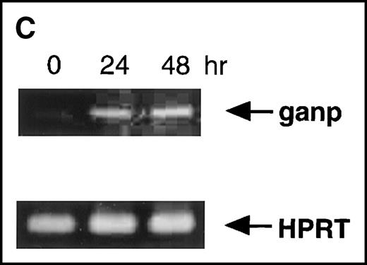 Fig. 3. Characterization of the GANP protein. / (A) The GANP protein is detected as a 210-kd protein in cytoplasmic and nuclear fractions from WEHI-231 by Western blot analysis after immunoprecipitation with the anti-GANP 42-23 mAb. Anti-glutathione-S-transferase (GST) mAb was used as an isotype-matched control mAb. (B) Spleen B cells from normal BALB/c mice were stimulated with F(ab′)2 of goat anti-μ Ab (10 μg/mL) and anti-CD40 mAb (10 μg/mL) for 48 hours and stained with the anti-GANP 29-15 mAb. The upper panel shows the profile of the cytoplasmic staining analyzed by the flow cytometry (FACScan). After permeabilization, cells were stained with the 29-15 mAb followed by fluorescein isothiocyanate-conjugated anti-κ. Two-color staining with phycoerythrin-B220 mAb showed the increase of GANP in B220-positive B cells. The lower panel shows cytostaining on the smears with the 29-15 mAb in combination with ALP-antirat Ig. (C) Reverse transcriptase-polymerase chain reaction assay showed the up-regulation of ganp messenger RNA in B cells stimulated with antimouse μ Ab and anti-CD40 in vitro. HPRT was used as a control to confirm the amount of each template. (D) The cell lysate was prepared from unstimulated (left) or stimulated (right) cells and subjected to anti-GANP immunoprecipitation. In vitro kinase reaction was carried out for 10 minutes with the anti-GANP 42-23 immunoprecipitates in the presence of γ-adenosine triphosphate labeled with phosphorous 32. Phosphorylation on the proteins was detected by autoradiography after separation with sodium dodecyl sulfate-polyacrylamide gel electrophoresis (SDS-PAGE). Arrow indicates the position of phosphorylated GANP.