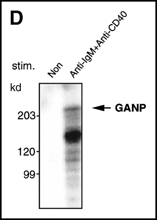 Fig. 3. Characterization of the GANP protein. / (A) The GANP protein is detected as a 210-kd protein in cytoplasmic and nuclear fractions from WEHI-231 by Western blot analysis after immunoprecipitation with the anti-GANP 42-23 mAb. Anti-glutathione-S-transferase (GST) mAb was used as an isotype-matched control mAb. (B) Spleen B cells from normal BALB/c mice were stimulated with F(ab′)2 of goat anti-μ Ab (10 μg/mL) and anti-CD40 mAb (10 μg/mL) for 48 hours and stained with the anti-GANP 29-15 mAb. The upper panel shows the profile of the cytoplasmic staining analyzed by the flow cytometry (FACScan). After permeabilization, cells were stained with the 29-15 mAb followed by fluorescein isothiocyanate-conjugated anti-κ. Two-color staining with phycoerythrin-B220 mAb showed the increase of GANP in B220-positive B cells. The lower panel shows cytostaining on the smears with the 29-15 mAb in combination with ALP-antirat Ig. (C) Reverse transcriptase-polymerase chain reaction assay showed the up-regulation of ganp messenger RNA in B cells stimulated with antimouse μ Ab and anti-CD40 in vitro. HPRT was used as a control to confirm the amount of each template. (D) The cell lysate was prepared from unstimulated (left) or stimulated (right) cells and subjected to anti-GANP immunoprecipitation. In vitro kinase reaction was carried out for 10 minutes with the anti-GANP 42-23 immunoprecipitates in the presence of γ-adenosine triphosphate labeled with phosphorous 32. Phosphorylation on the proteins was detected by autoradiography after separation with sodium dodecyl sulfate-polyacrylamide gel electrophoresis (SDS-PAGE). Arrow indicates the position of phosphorylated GANP.