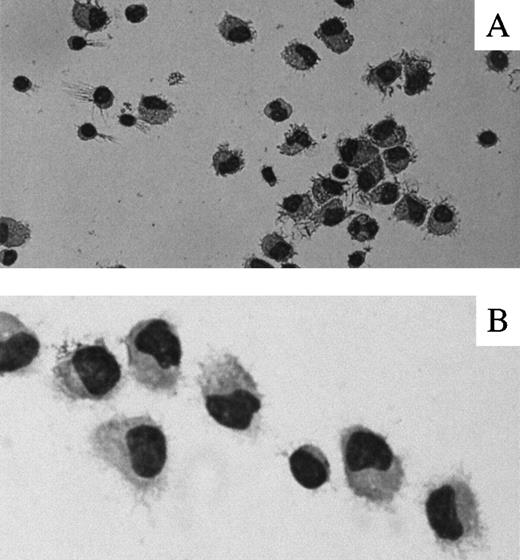 Fig. 1. Morphology of human PBMC-derived DCs. / Representative photographs of Wright-Giemsa–stained cytospins of adherent PBMCs from healthy donors cultured for 7 days in the presence of GM-CSF and IL-4 are presented. (A) ×400. (B) ×1000.