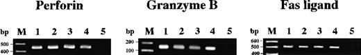 Fig. 1. Expression of cytolytic mediators in alloantigen-specific human CD4+ and CD8+ CTLs. Expression of messenger RNAs (mRNAs) for perforin, granzyme B, and Fas ligand was investigated by RT-PCR. The mRNAs were extracted from CD4+clone #1-1 (lane 1), CD4+ clone #3-1 (lane 2), CD8+ clone #2-1 (lane 3), CD8+ clone #4-1 (lane 4), and a negative control B-cell line (lane 5). Lane M shows 100-bp ladder markers.