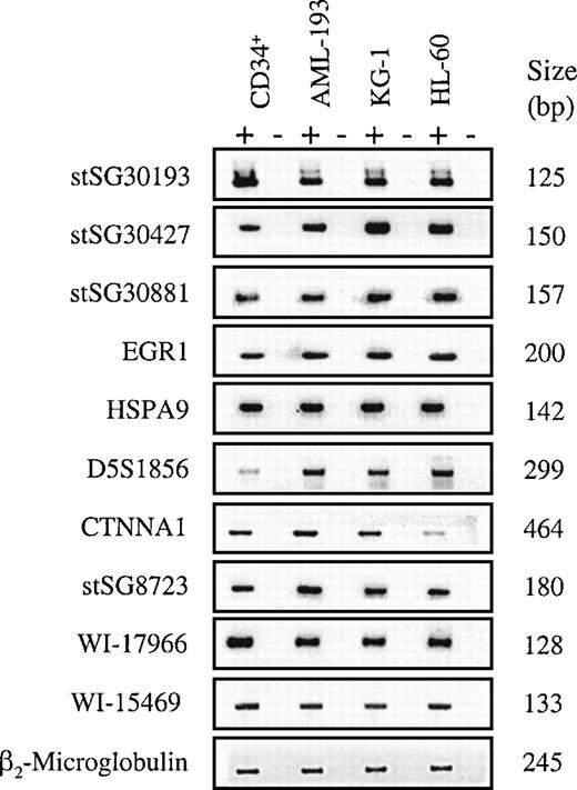 Fig. 4. Expression analysis of candidate genes/ESTs. / RT-PCR was performed on human bone marrow CD34+ cells and myeloid cell lines, AML-193, KG-1, and HL-60, as indicated, and was visualized by agarose gel electrophoresis and ethidium bromide staining. The left column lists the gene or EST that was tested, using the PCR primers indicated in Table 2. The right column indicates the product size in base pairs. The PCR results are displayed for each primer set, with or without the addition of RT, indicated by (+) or (−), respectively. Negative controls for template pairs (no RNA added) is not shown. β2-Microglobulin primers were used as the positive control for RT-PCR.
