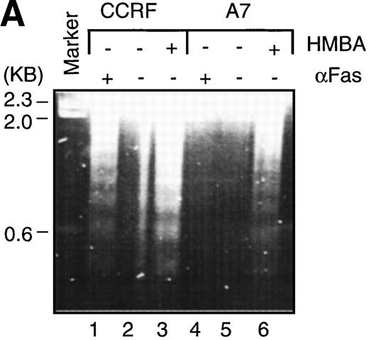 Fig. 3. Hexamethylene bisacetamide (HMBA)-induced nuclear damage indicative of apoptosis. / (A) CCRF and A7 CEM cells were untreated or cultured for 48 hours with 10 mmol/L HMBA or for 4 hours with 100 ng/mL anti-Fas antibody (CH-11). Genomic DNA was extracted and run on a 2% agarose gel. CCRF and A7 CEM cells were treated for 48 hours with 10 mmol/L HMBA and assayed by TUNEL for DNA fragmentation as denoted by an increase in mean channel fluorescence (B) and Hoechst 33 258 staining (C) for chromatin condensation. The percentage of TUNEL-positive cells are shown above each histogram, and cells displaying chromatin condensation are indicated by an arrow. Lysates from CCRF and A7 cells treated for 72 hours with 0-20 mmol/L HMBA were separated by SDS-PAGE, and Western blots were performed using polyclonal anti-PARP antibody (D). The active form of PARP migrates as a 118-kD protein and cleaved to an inactive form of approximately 89 kd.