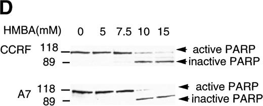 Fig. 3. Hexamethylene bisacetamide (HMBA)-induced nuclear damage indicative of apoptosis. / (A) CCRF and A7 CEM cells were untreated or cultured for 48 hours with 10 mmol/L HMBA or for 4 hours with 100 ng/mL anti-Fas antibody (CH-11). Genomic DNA was extracted and run on a 2% agarose gel. CCRF and A7 CEM cells were treated for 48 hours with 10 mmol/L HMBA and assayed by TUNEL for DNA fragmentation as denoted by an increase in mean channel fluorescence (B) and Hoechst 33 258 staining (C) for chromatin condensation. The percentage of TUNEL-positive cells are shown above each histogram, and cells displaying chromatin condensation are indicated by an arrow. Lysates from CCRF and A7 cells treated for 72 hours with 0-20 mmol/L HMBA were separated by SDS-PAGE, and Western blots were performed using polyclonal anti-PARP antibody (D). The active form of PARP migrates as a 118-kD protein and cleaved to an inactive form of approximately 89 kd.