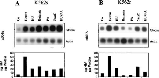 Fig. 3. Induction of globin gene expression by different chemical agents in K562 cells. / Cells were treated with hemin, hydroxyurea, butyrate, phenylacetate, 5-azacytidine, or phenylacetate plus hydroxyurea for 4 days. For Northern blot analysis, total RNA was prepared, subjected to agarose gel electrophoresis and blotted on nylon membranes. Blots were hybridized with a 32P-labeled probe of the γ-globin coding region. After stripping, blots were rehybridized with a β-actin probe. Hemoglobin and protein concentrations of total cell extracts were determined as described. A shows results from butyrate-sensitive K562s cells and B results from butyrate-resistant K562r cells.