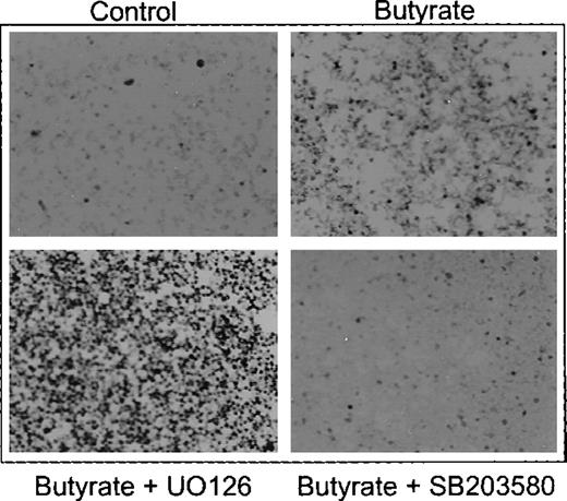 Fig. 4. Benzidine staining of K562 cells treated with butyrate in the presence of ERK inhibitor UO126 and p38 inhibitor SB203580, respectively. / Cells were cultured in the absence (control) or presence of butyrate alone (butyrate) or with butyrate plus UO126 (butyrate + UO126) and SB203580 (butyrate + SB203580), respectively. After harvesting, intracellular hemoglobin was detected by benzidine-staining and cell smears were subjected to microscopy using 100× magnification.