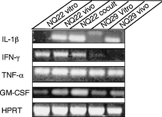 Fig. 7. Differential expression of cytokines in NQ22 and NQ29 lymphoma cells. / Total RNA was extracted from 107 NQ22 and NQ29 cells grown in vitro, from a spleen heavily infiltrated with NQ22 cells, from NQ22 cells cocultured with H-end80 cells, and from NQ29 cells from a subcutaneous tumor mass. RNA was reverse transcribed and amplified with primers specific for IL-1β, IFN-γ, TNF-α, GM-CSF, and HPRT as detailed in “Materials and methods.” Aliquots of the nested PCRs were separated by 2% agarose gel and visualized by ethidium bromide and ultraviolet light. Only the relevant part of the gel is shown.
