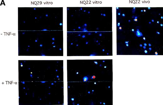 Fig. 11. Activated endothelium can up-regulate the expression of 4 integrins on NQ22 cells. / H-end80 cells grown to confluence were left untreated (upper panels) or were treated for 16 hours with 10 ng/mL TNF-α (lower panels) and then were cocultured for 24 hours with NQ22 or NQ29 cells grown in vitro. At the end of the incubation period, NQ cells were collected, the expression of α4 integrin subunit was determined with the use of PS/2 mAb, and the reactivity was examined by confocal fluorescence microscopy with pseudocolor enhancement. NQ22 cells from heavily infiltrated spleen (NQ22 vivo) were used as positive control. Selected fields with a relatively higher percentage of positive cells were chosen for display for NQ22 and NQ29 cells (A), whereas the percentage of positive cells is graphically depicted (B).