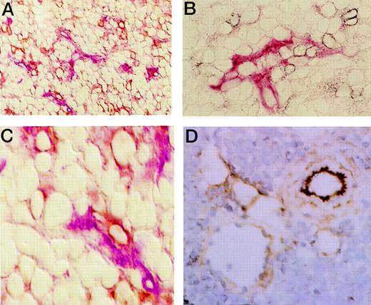 Fig. 3. Immunohistochemical staining of SC tumor masses. / Immunolabeling of cryostat sections of masses at their initial growth was performed with anti-α4β7 and anti-VCAM-1 (A, C) or with anti-α4β7 and anti-CD31 (B) mAbs on NQ22 cells or with anti-VCAM-1 alone on NQ29 cells (D). Brown, α4β7; red, CD31 and VCAM-1. Magnification, × 200 (A, B) and × 400 (C, D).