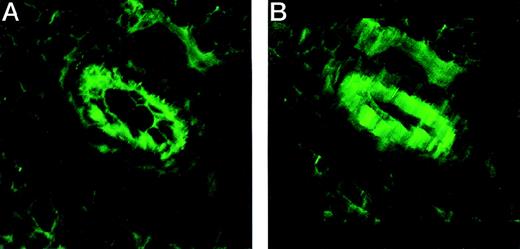 Fig. 10. VCAM-1 is expressed on both the apical and the basolateral surfaces of endothelial cells in vivo. / Cryostat sections of NQ22 masses at their initial SC growth were fixed in acetone–methanol and stained with anti VCAM-1 mAb M/K-2 and visualized with fluorescein-conjugated goat antimouse IgG. (A) Detail of the 2-dimensional reconstruction. (B) Detail of the tridimensional reconstruction of a series of sections taken in 0.13-μm steps through a tissue section in which 2 blood vessels are clearly evident.
