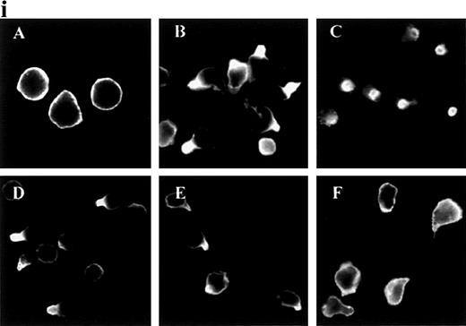 Fig. 1. Redistribution of adhesion receptors to the uropod of neutrophils stimulated by chemoattractants. / (i) Neutrophils were allowed to bind to coverslips coated with 20 μg/mL of an 80-kd fibronectin (FN80) fragment for 10 minutes at 37°C and stimulated with interleukin 8 (IL-8) for an additional 5 minutes. Neutrophils were then fixed and stained with the following monoclonal antibodies (mAb): anti-intercellular adhesion molecule 3 (ICAM-3) TP1/25 (B), anti-P-selectin glycoprotein ligand 1 (PSGL-1) KPL-1 (C), anti-CD43 TP1/36 (D), anti-CD44 HP2/9 (E), and anti-CD45 D3/9 (F). The control was unstimulated neutrophils stained with the anti-ICAM-3 TP1/25 mAb (A). (ii) Neutrophils were stimulated in the presence of 2 nmol/L of C5a (A, B, and C),N-formyl-methionyl-leucyl-phenylalanine (D, E, and F), or tumor necrosis factor (TNF-α) (G, H, and I) for 5 minutes at 37°C. Cells were then fixed and stained with the following mAb: anti-ICAM-3 TP1/25 (A, D, and G), anti-PSGL-1 KPL1 (B, E, and H), and anti-CD45 D3/9 (C, F, and I).
