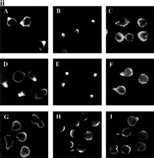 Fig. 1. Redistribution of adhesion receptors to the uropod of neutrophils stimulated by chemoattractants. / (i) Neutrophils were allowed to bind to coverslips coated with 20 μg/mL of an 80-kd fibronectin (FN80) fragment for 10 minutes at 37°C and stimulated with interleukin 8 (IL-8) for an additional 5 minutes. Neutrophils were then fixed and stained with the following monoclonal antibodies (mAb): anti-intercellular adhesion molecule 3 (ICAM-3) TP1/25 (B), anti-P-selectin glycoprotein ligand 1 (PSGL-1) KPL-1 (C), anti-CD43 TP1/36 (D), anti-CD44 HP2/9 (E), and anti-CD45 D3/9 (F). The control was unstimulated neutrophils stained with the anti-ICAM-3 TP1/25 mAb (A). (ii) Neutrophils were stimulated in the presence of 2 nmol/L of C5a (A, B, and C),N-formyl-methionyl-leucyl-phenylalanine (D, E, and F), or tumor necrosis factor (TNF-α) (G, H, and I) for 5 minutes at 37°C. Cells were then fixed and stained with the following mAb: anti-ICAM-3 TP1/25 (A, D, and G), anti-PSGL-1 KPL1 (B, E, and H), and anti-CD45 D3/9 (C, F, and I).