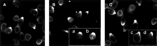 Fig. 3. Redistribution of PSGL-1, ICAM-3, and moesin to the uropod of polarized neutrophils. / Neutrophils adhering to FN80 were stimulated with IL-8 for 5 minutes. Cells were then fixed and stained. (A) ICAM-3. (B) PSGL-1. Inset shows colocalization of PSGL-1 (a) and ICAM-3 (b). (C) Moesin. Inset shows colocalization of moesin (c) and ICAM-3 (d).